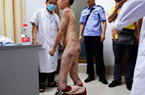 男童遭继母家暴遍体鳞伤