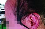 女大学生沸水泼老师脸